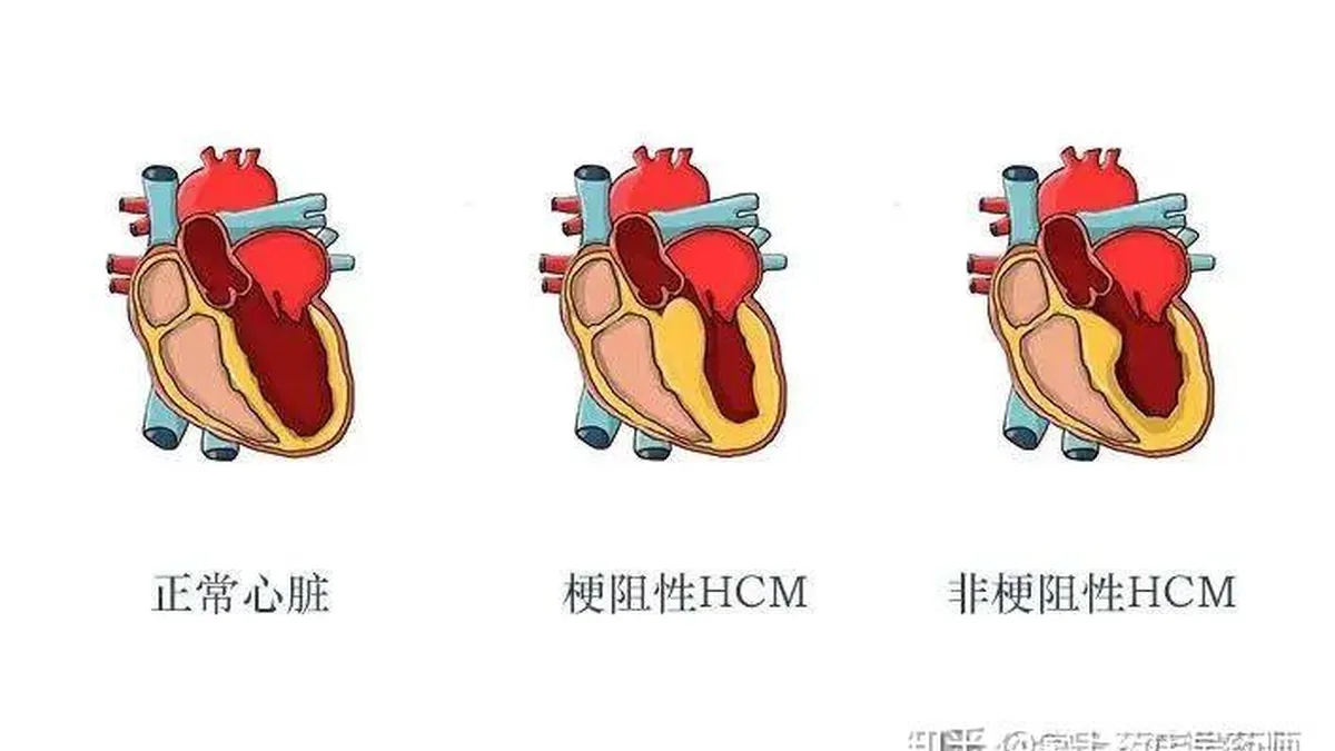 玛伐凯泰医院药房价格咨询场景